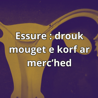 [TEASER] Essure : implantoù pistrius e korf ar merc'hed